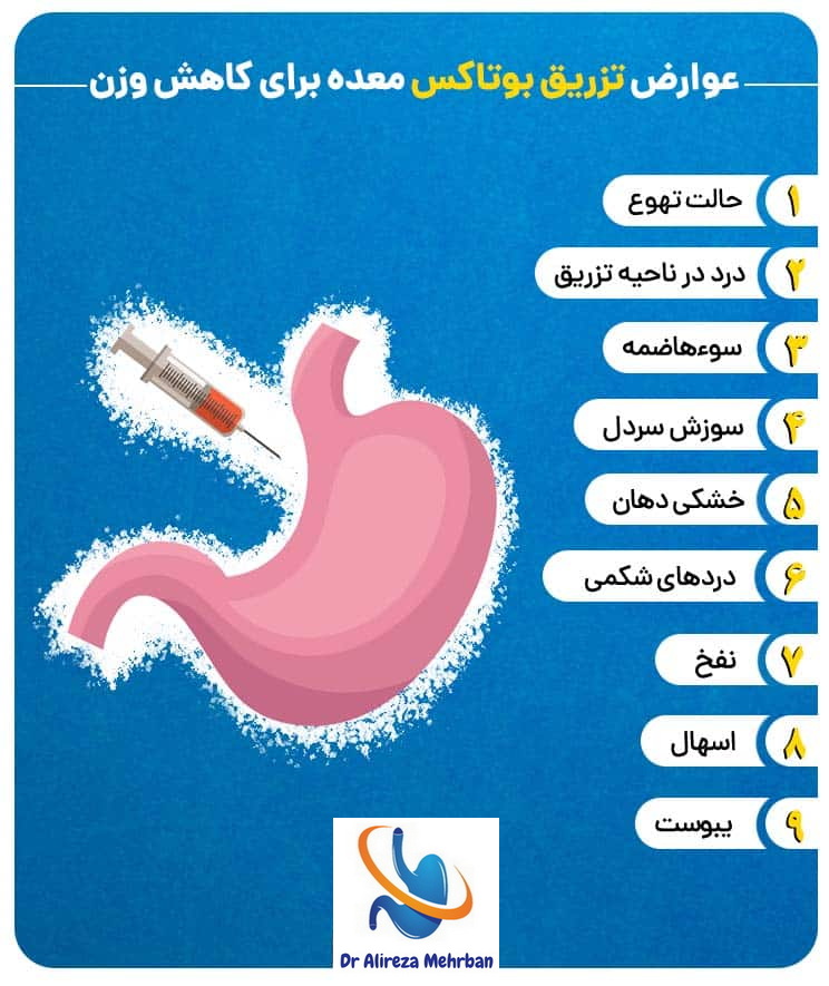 بعد از عمل اسلیو چقدر باید راه رفت+بوتاکس معده چگونه است+بوتاکس معده برای چه وزنی مناسب است+کدام عمل لاغری بدون بازگشت است